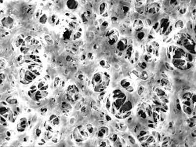 龍世紀 聚合物涂覆隔膜